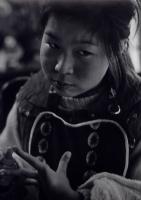 W. Eugene Smith - Minamata Series - Jitsuko-chan